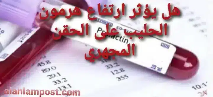 ارتفاع هرمون الحليب