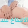 علاج الانتفاخ عند الرضع