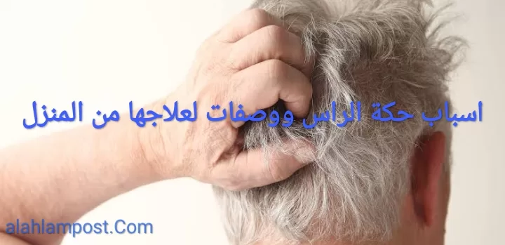 اسباب حكة الراس